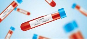 Новости: Затраты на тестирование работников на COVID-19 уменьшают «прибыльную» базу