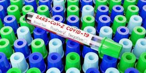 Новости: Может ли упрощенец учесть расходы на коронавирусное тестирование работников