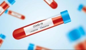 Новости: Оплата тестирования на COVID-19 не облагается страховыми взносами